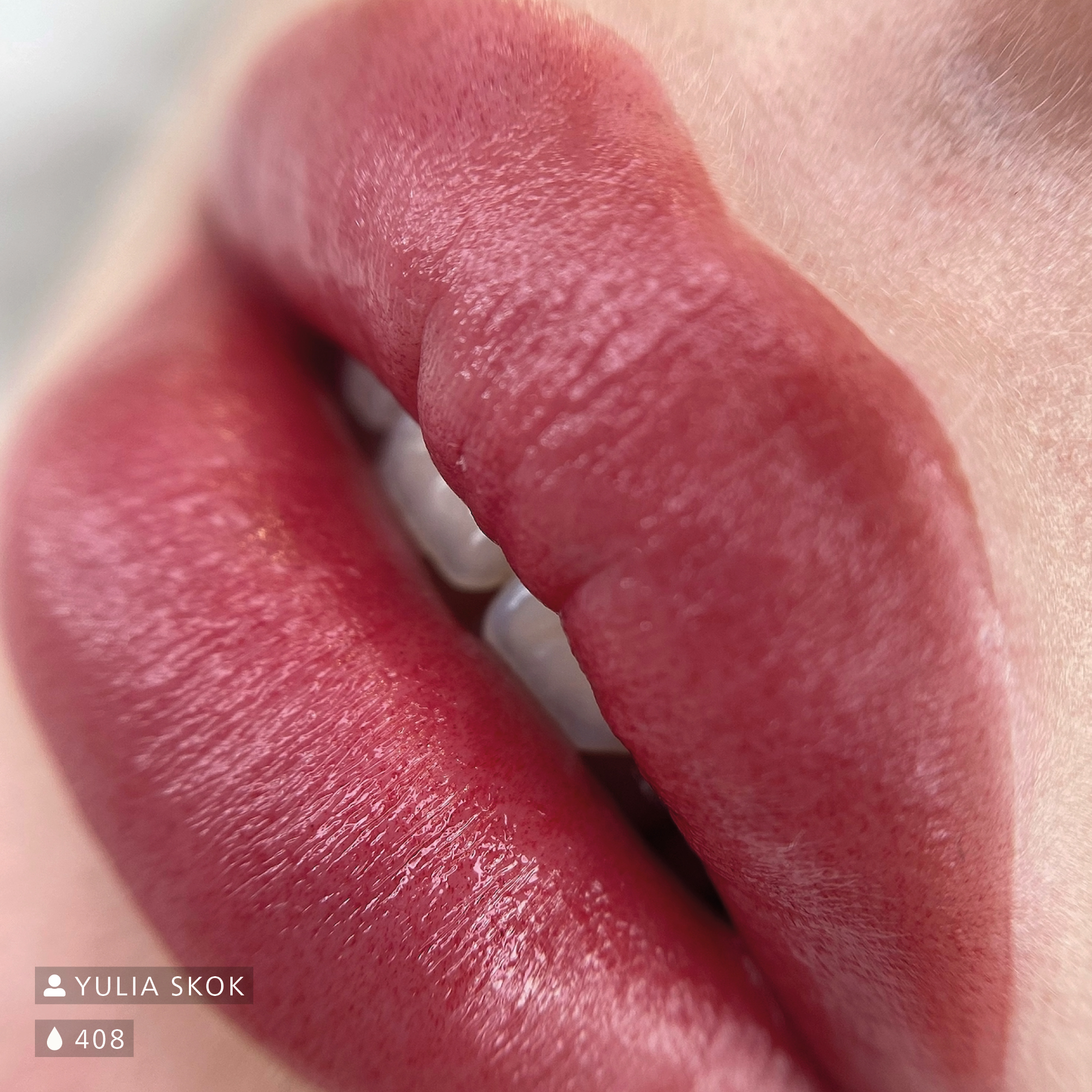 Rot-braun pigmentierte Lippen