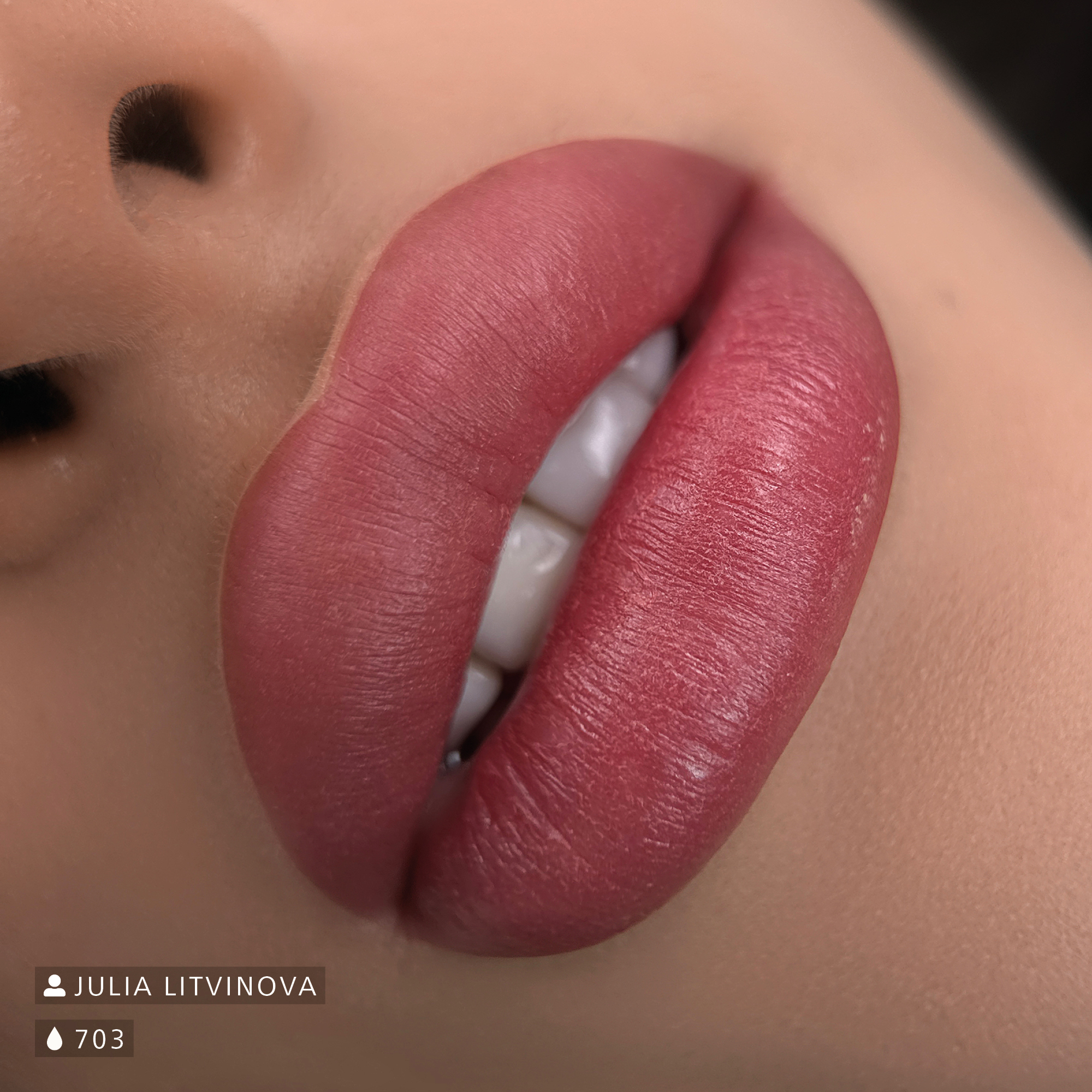 Nahaufnahme von pigmentierten Lippen in einem satten Rot direkt nach der Behandlung